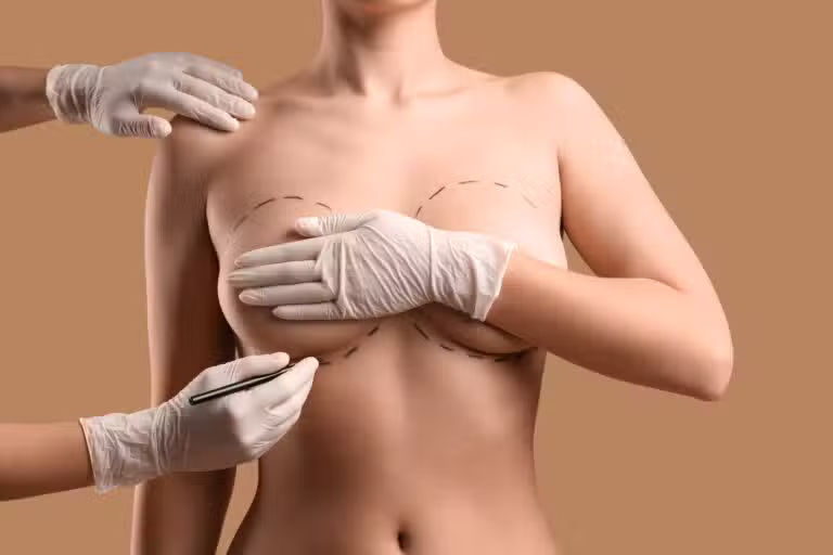 Your Guide to Preparing for Breast Augmentation Surgery