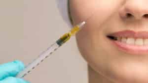 Woman smiling getting Sculptra injections in Savannah, GA