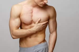 Man with nice chest contour after gynecomastia surgery in Savannah, GA